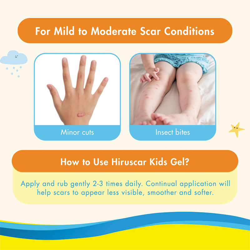 HIRUSCAR KIDS 10G