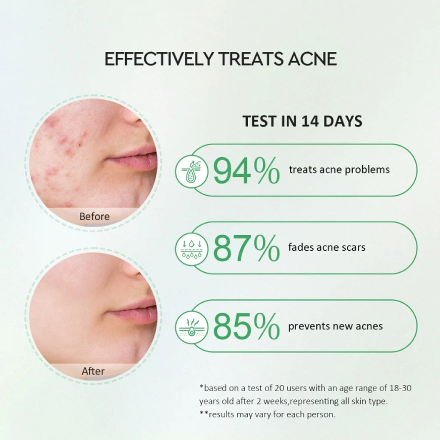 GLAD2GLOW CENTELLA SALICYLIC ACID POWER ACNE SERUM 17ML