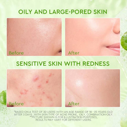 GLAD2GLOW CENTELLA SALICYLIC ACID ACNE GEL CLEANSER 70ML