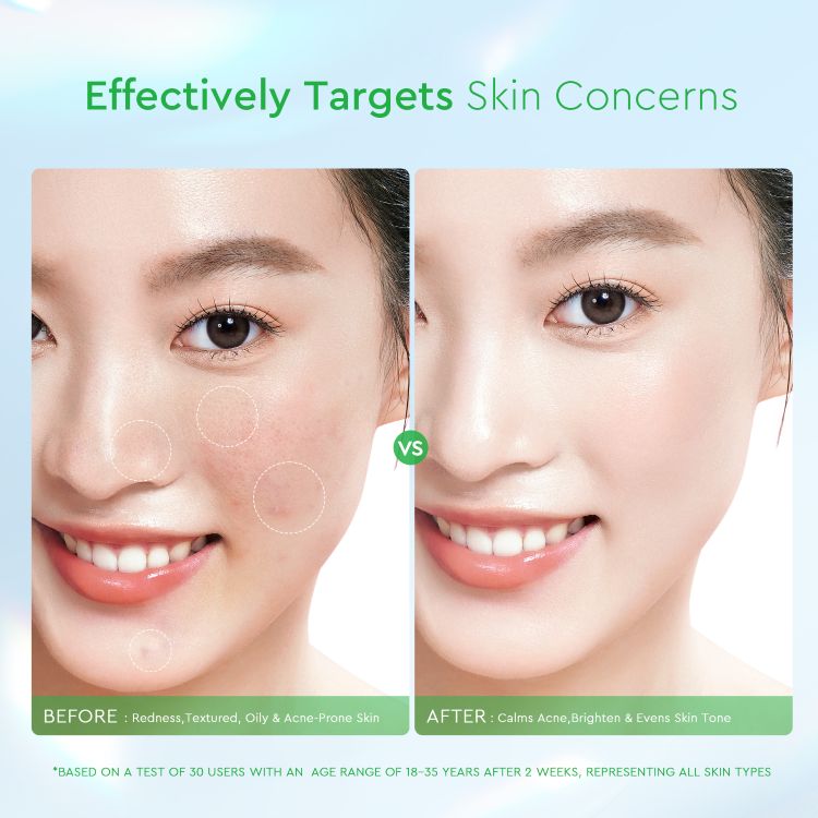 GLAD2GLOW CENTELLA SALICYLIC ACID EXFOLIATING ACNE PADS 30 PCS