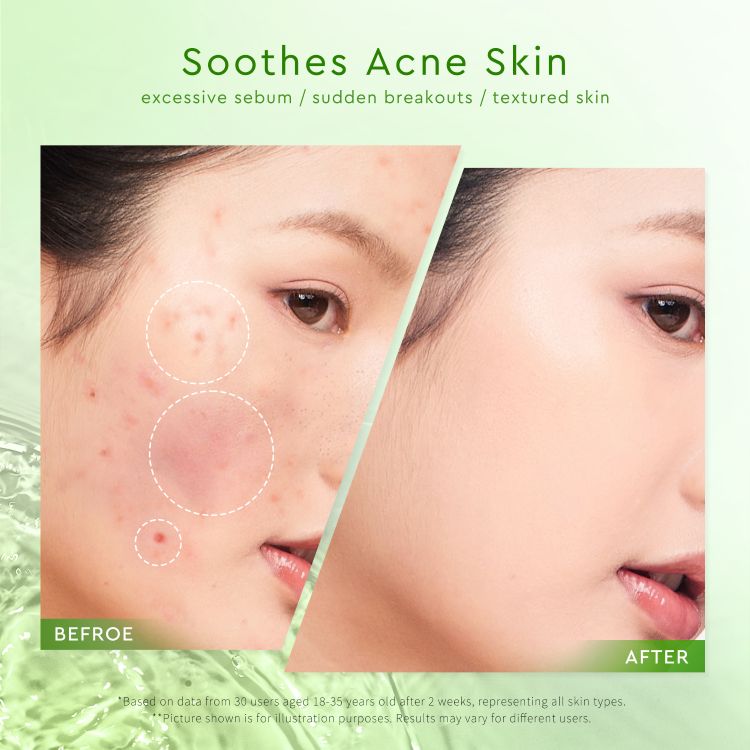 GLAD2GLOW MUGWORT ACNE GEL MASK 50G