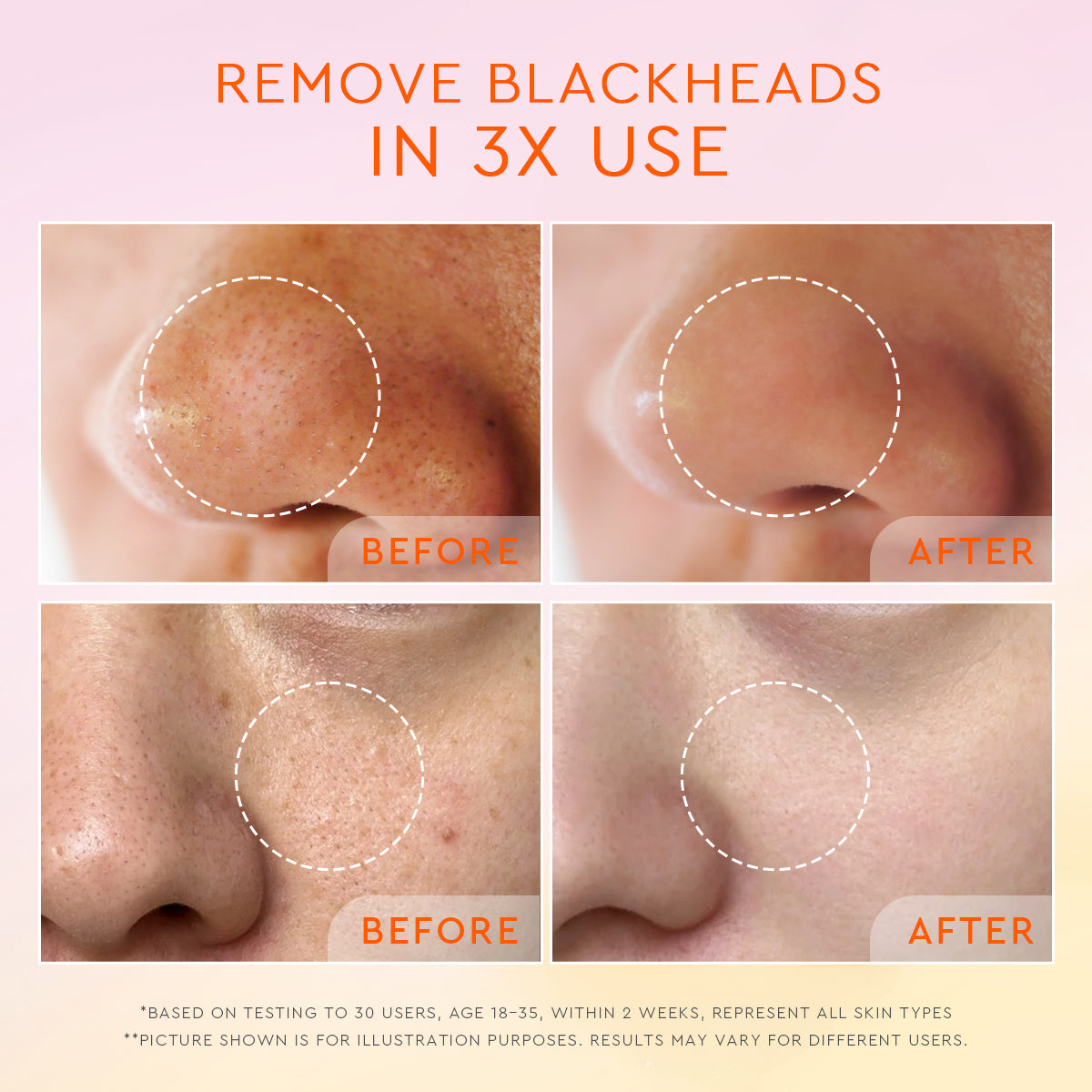 GLAD2GLOW YUZU AHA BLACKHEAD EXFOLIATING CLEANSER 70G
