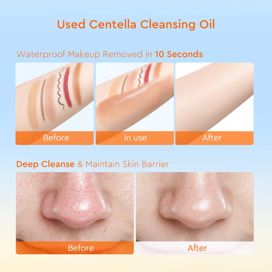 GLAD2GLOW MADAGASCAR CENTELLA LIGHT CLEANSING OIL 100ML