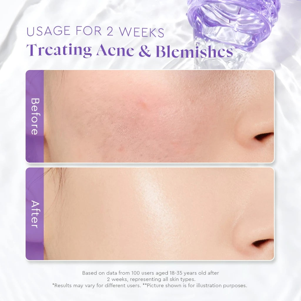 GLAD2GLOW BLACKBERRY AHA BHA PHA EXFOLIATING TONER 80ML