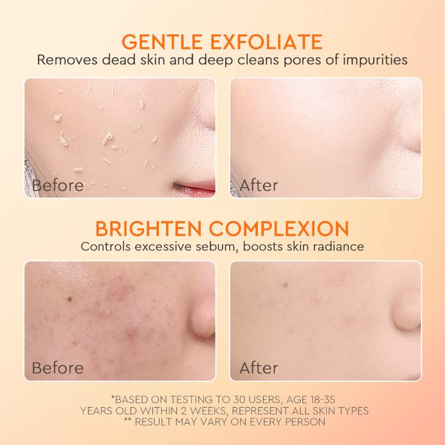 GLAD2GLOW APRICOT GLYCOLIC ACID EXFO SMOOTH PEELING GEL 50G