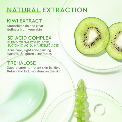 GLAD2GLOW KIWI 3D ACID ACNE MOISTURIZER 30G