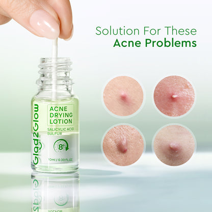 GLAD2GLOW ACNE DRYING LOTION 10ML