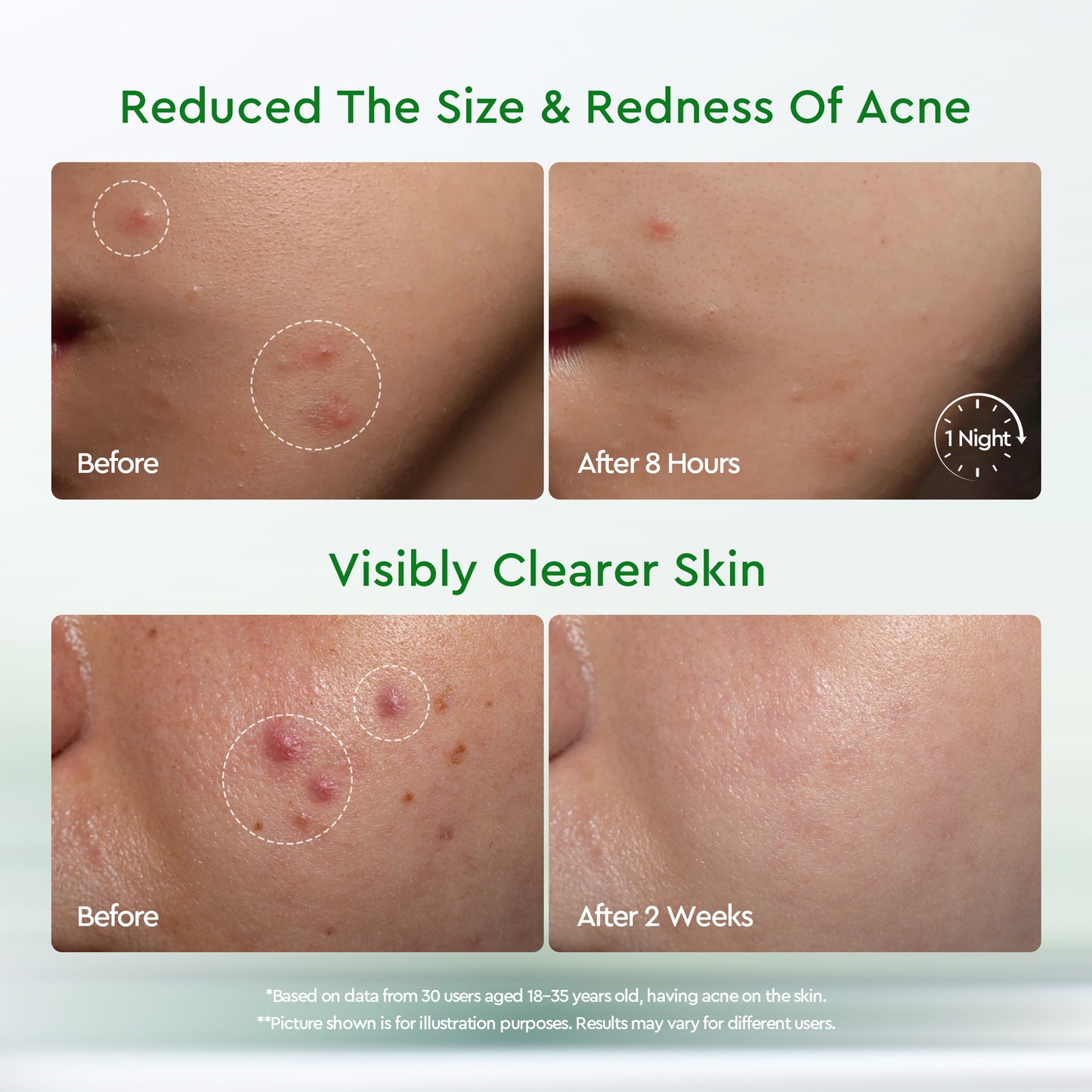 GLAD2GLOW ACNE DRYING LOTION 10ML