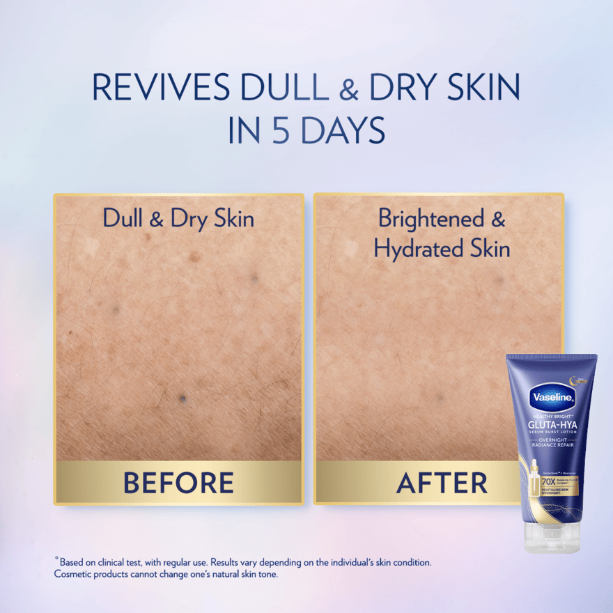 VASELINE HEALTHY BRIGHT GLUTA-HYA O/NGT RADIANCE REPAIR SERUM B/LOTION 70ML