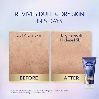 VASELINE HEALTHY BRIGHT GLUTA-HYA O/NGT RADIANCE REPAIR SERUM B/LOTION 300ML