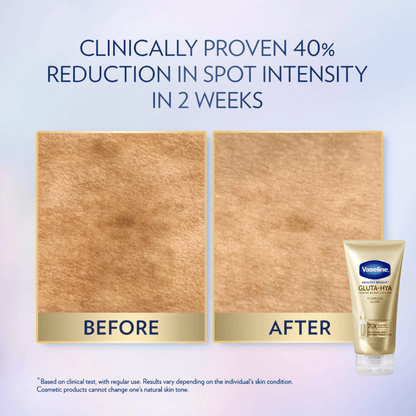 VASELINE HEALTHY BRIGHT GLUTA-HYA FLAWLESS BRIGHT SERUM B/LOTION 300ML