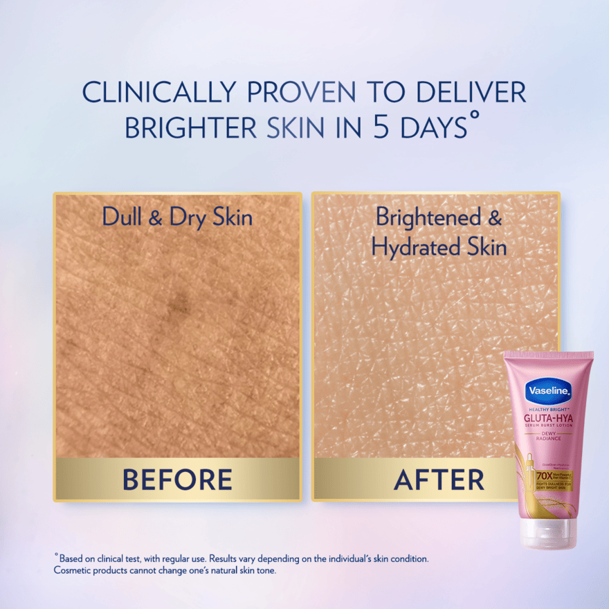 VASELINE HEALTHY BRIGHT GLUTA-HYA DEWY RADIANCE SERUM B/LOTION 70ML