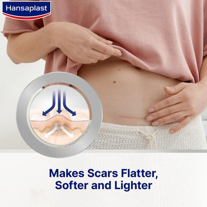 HANSAPLAST SCAR REDUCER XL 14.6X3CM 21S