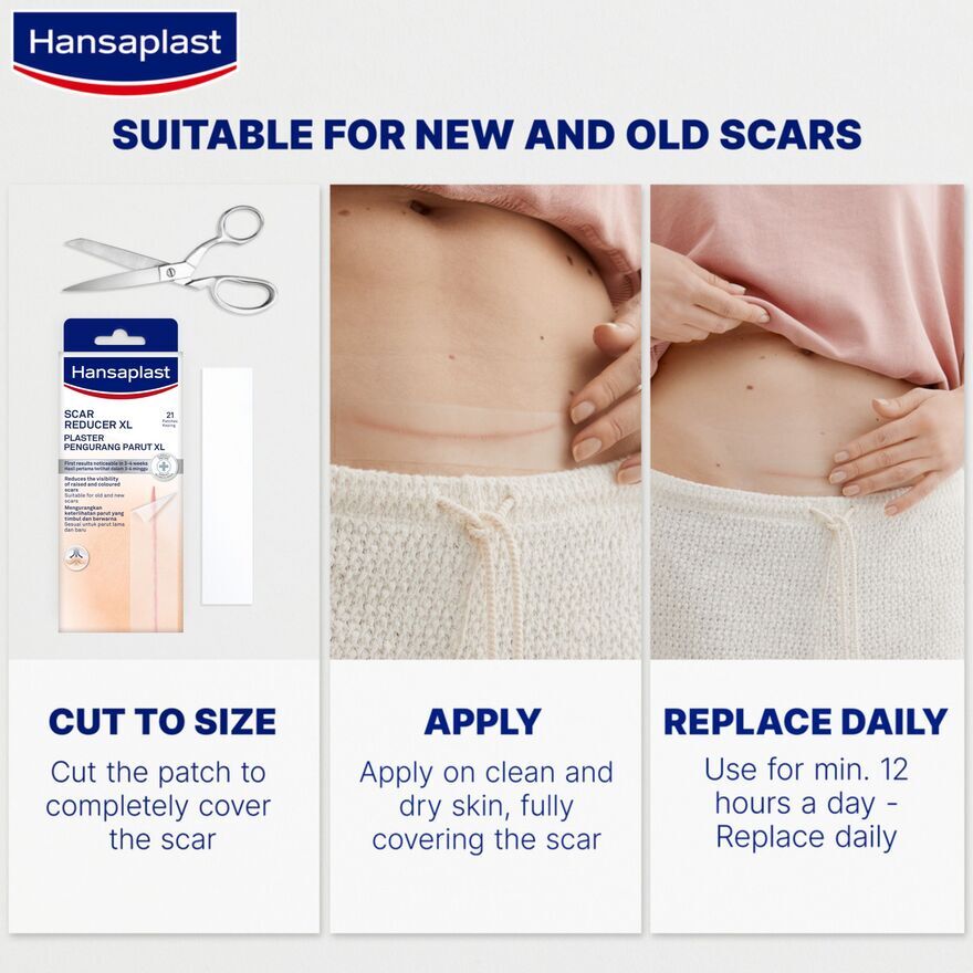 HANSAPLAST SCAR REDUCER XL 14.6X3CM 21S