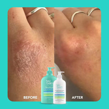 SUU BALM RAPID ITCH RELIEF MOISTURISER 350ML