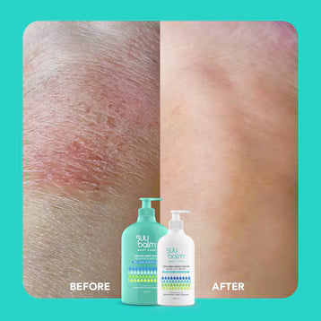 SUU BALM RAPID ITCH RELIEF MOISTURISER 350ML
