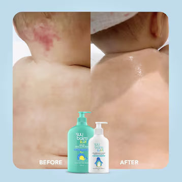 SUU BALM KIDS ITCH RELIEVING+RESTORING CERAMIDE MOISTURISER CREAM 200ML